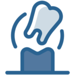 Implantes Dentários